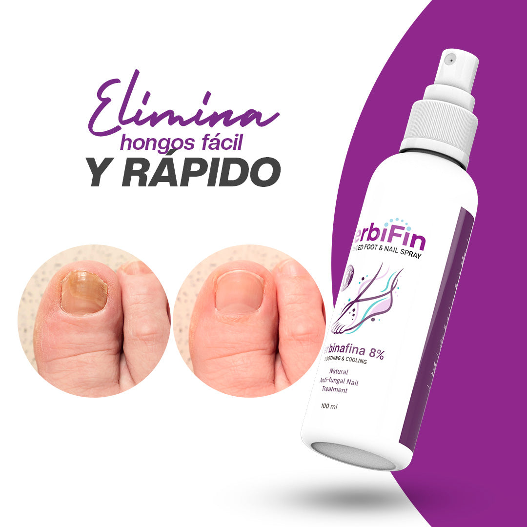 Spray Antihongos para Uñas